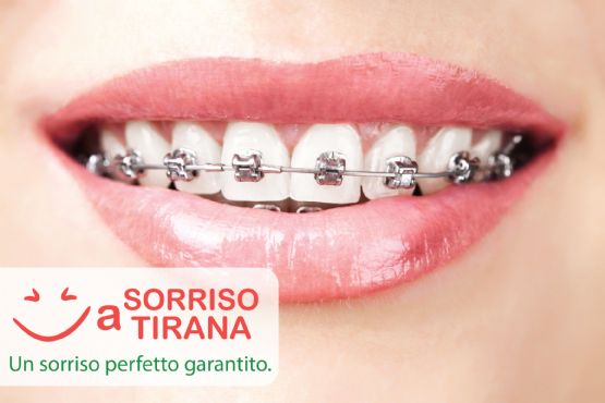 Dentisti in Albania, Denti in Albania, Estetica in zirconio, vantaggi e svantaggi  La corona dentale in zirconio in Albania, all on 4 impianti dentali, impianto dentale dolore